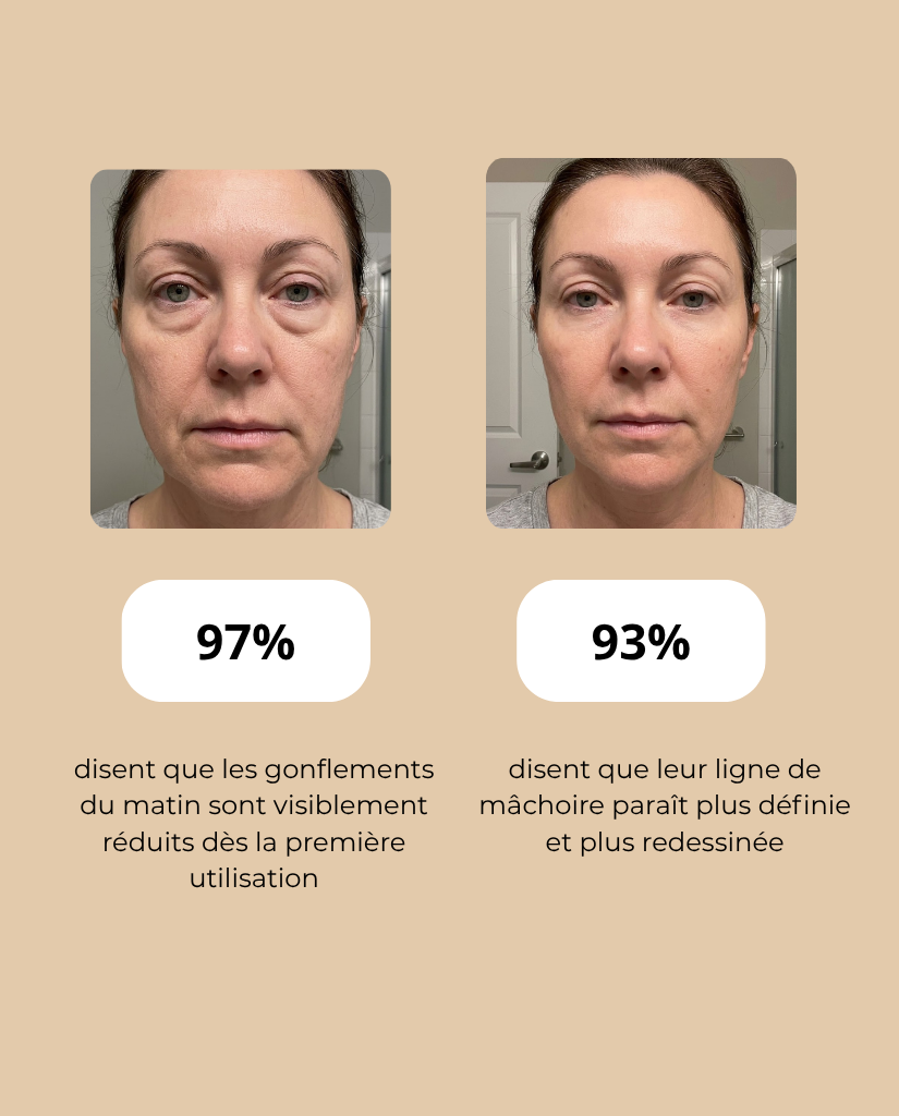 Brosse de Drainage Lymphatique Visage